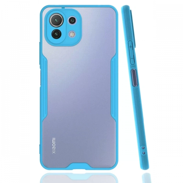 Xiaomi Mİ 11 Lite Kılıf Platin Silikon - Mavi