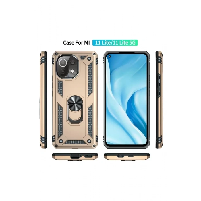 Xiaomi Mİ 11 Lite Kılıf Sofya Yüzüklü Silikon Kapak - Gold