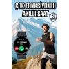 Akıllı Saat Çok Fonksiyonlu Sesli Görüşme NFC Uyumlu Amoled Ekran