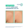 Bioderma Sebium Kerato Body Vücut Aknesi Karşıtı Sprey 150 ml