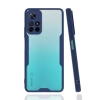 Xiaomi Redmi Note 11T Kılıf Platin Silikon - Lacivert