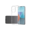 Xiaomi Redmi Note 13 Pro Plus Kılıf Lüx Şeffaf Silikon