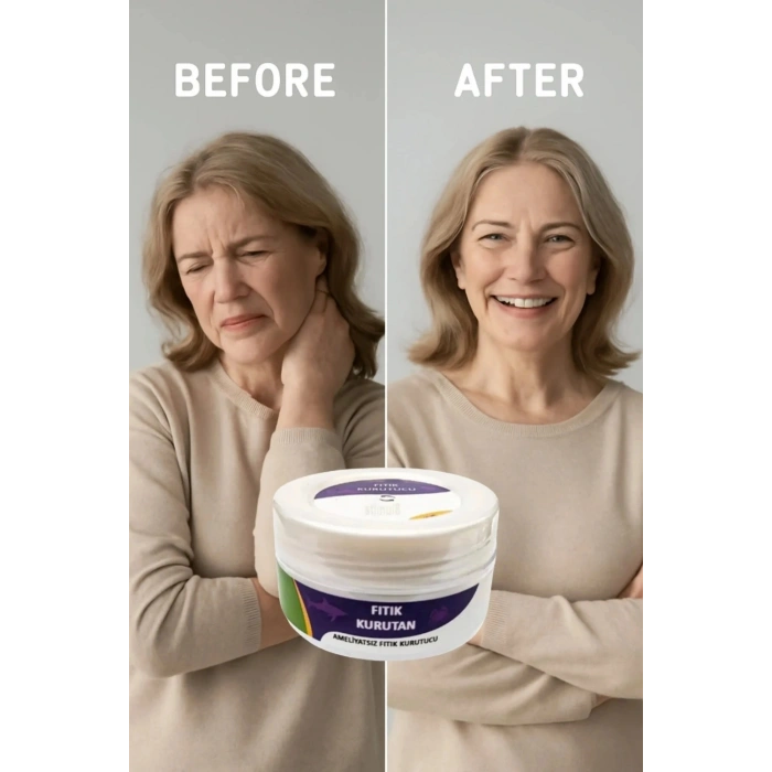 Fıtık Kurutan Krem 50 ml