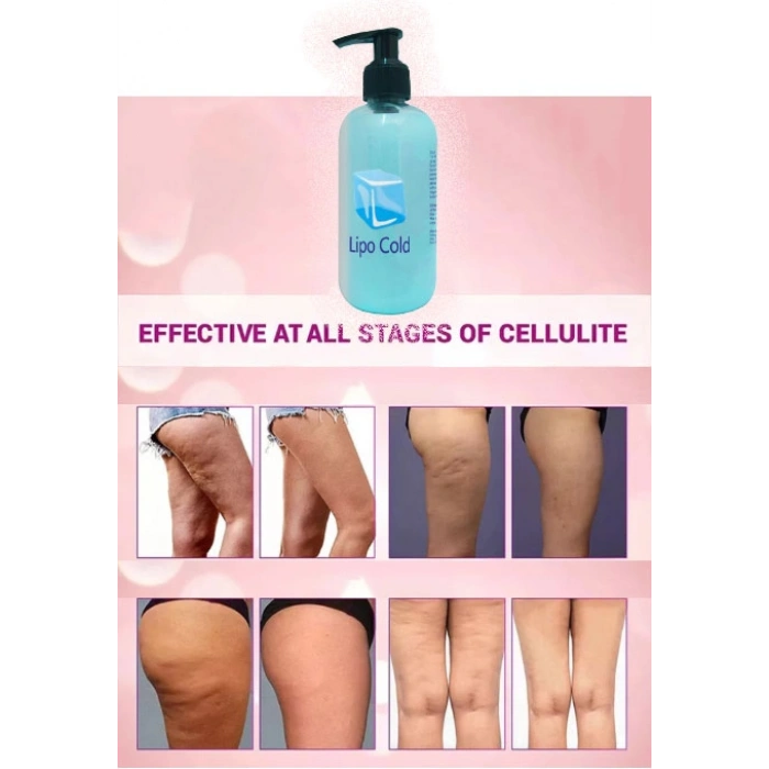 Lipo Cold Krem 250 ml