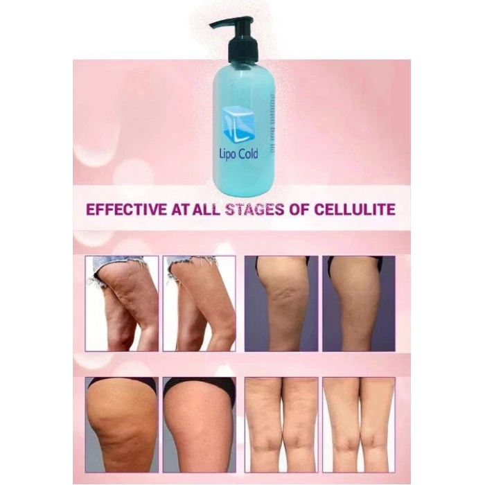 Lipo Cold  Masaj Kremi 250 ml x 1 Adet