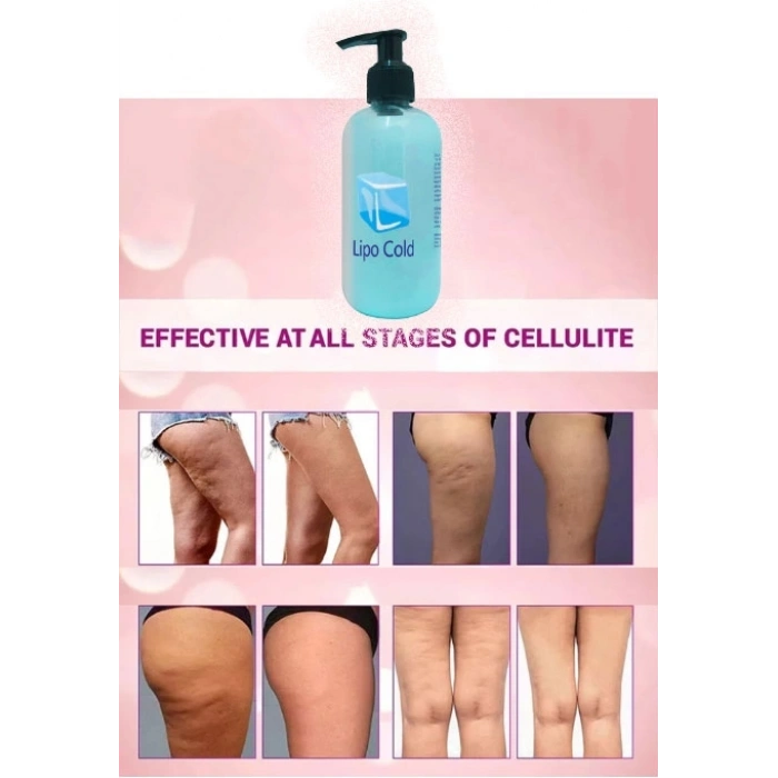 Lipo Cold Yeni Görünümünüze Krem 250 ml