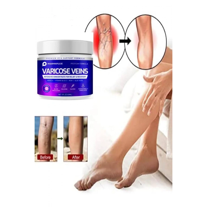 Maximum Strength Varicose Vein Var.is Bacak Bakım Masaj Kremi 100 ml