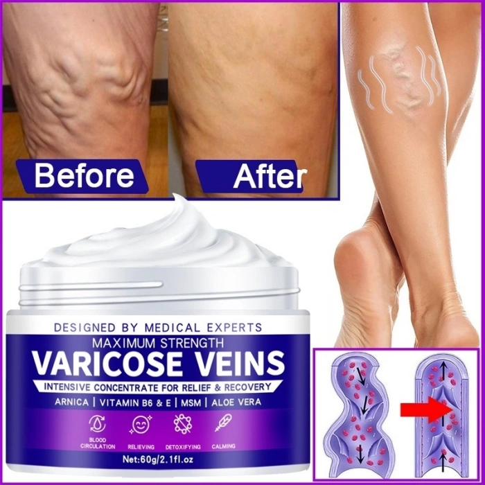 Maximum Strength Varicose Veins Krem 100 ml 1 Adt