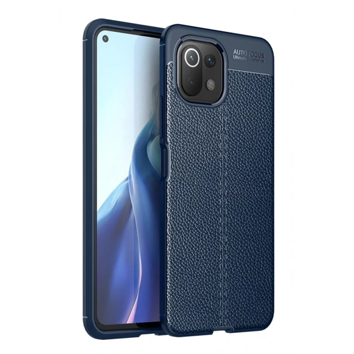 Xiaomi Mİ 11 Lite Kılıf Auto Focus Kapak - Lacivert