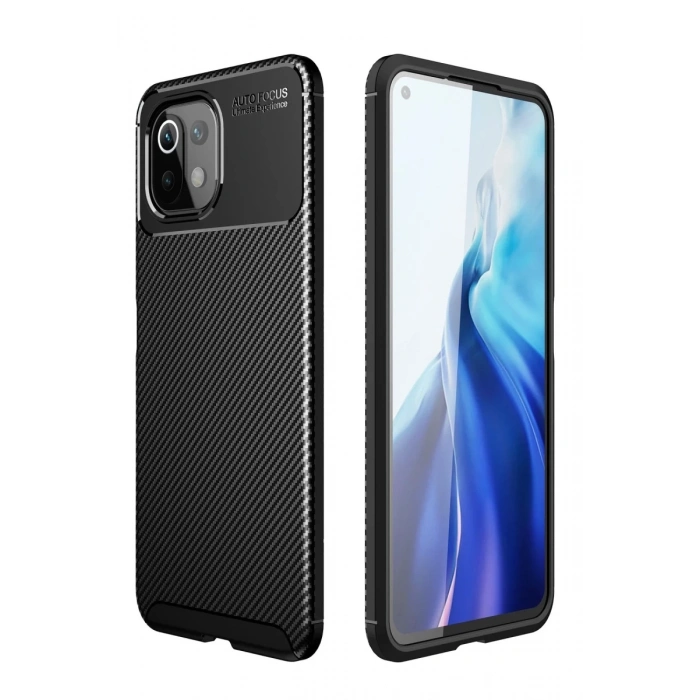 Xiaomi Mİ 11 Lite Kılıf Auto Focus Karbon Kapak - Siyah
