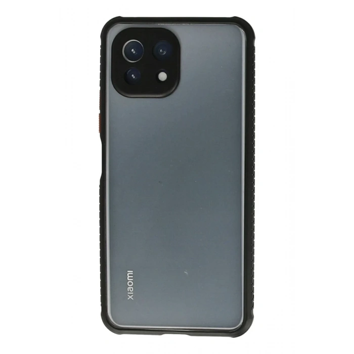 Xiaomi Mİ 11 Lite Kılıf Miami Şeffaf Silikon - Siyah