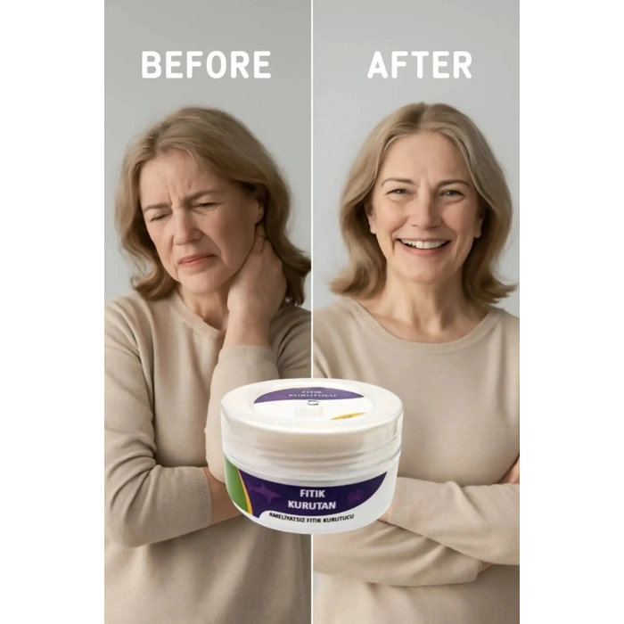 Süper Fıtık Kurutan Krem 50 ml