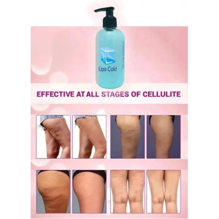 Süper Lipo Cold  G.çlü  Krem 250 ml x 2 Adet