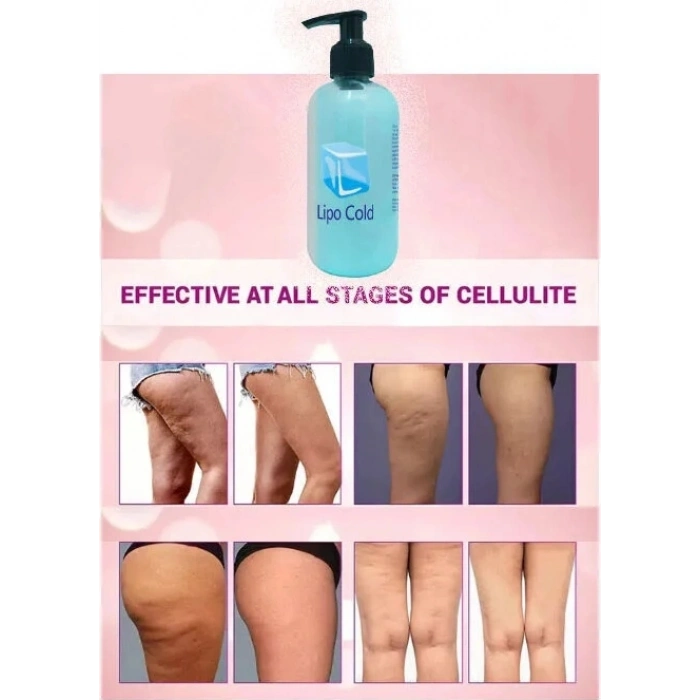 Süper Lipo Cold  Karşı Bakım Kremi 250 ml x 2 Adet