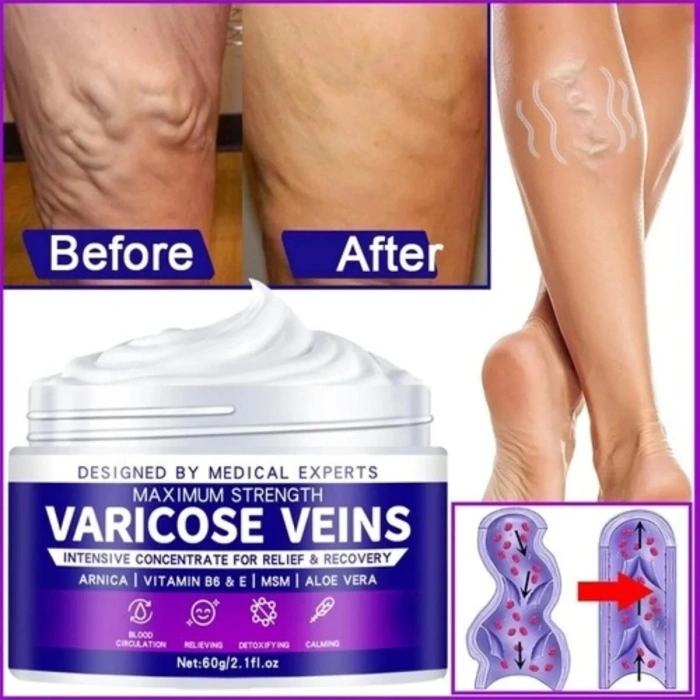 Süper Maximum Strngth Varcse Vnis Krem 100 ml 1 Adt