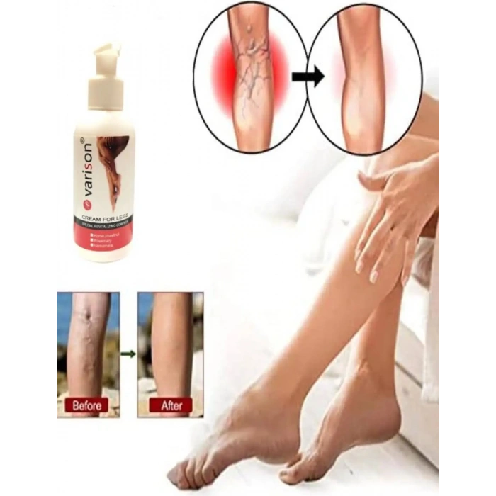 Süper Varison Bacak Bakım Kremi 120 ml
