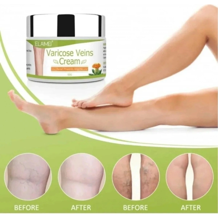 Varicose Kremi 100 ml