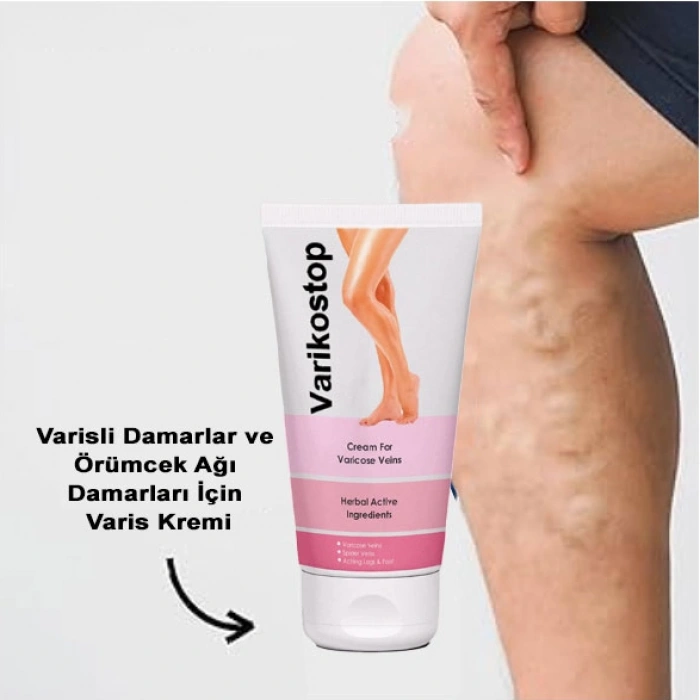 Varikostop Cream Yoğun Varisli Damarlar Için Effektif Krem