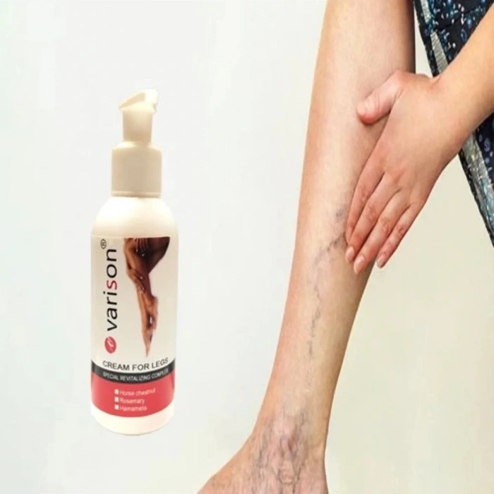 Varison Cream Dizbacak Bakım Kremi 120 ml 3 Adet