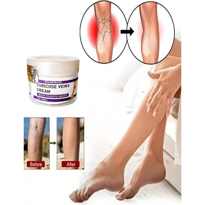 Varix Varcse Vnis Purple Bakım Kremi 100 ml