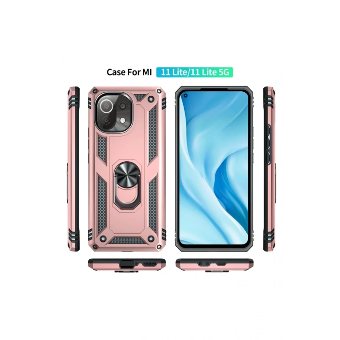 Xiaomi Mİ 11 Lite Uyumlu Kılıf Sofya Yüzüklü Silikon Kapak - Rose