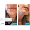 Dr. Botoks Cream Bakım Kremi 50 ml