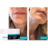 Dr. Botoks LiderGlobal Dr. Botoks 2 Adet Krem 50 ml