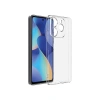 General Mobile Era 50 Kılıf Lüx Şeffaf Silikon