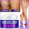 Maximum Strength Varicose Veins Krem 100 ml 1 Adt