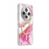 Onegif Xiaomi Redmi 14C Lotus Simli Magsafe Kapak - Pembe