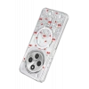 Onegif Xiaomi Redmi 14C Misk Simli Magsafe Kapak - Desen 5