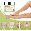Varicose Kremi 100 ml