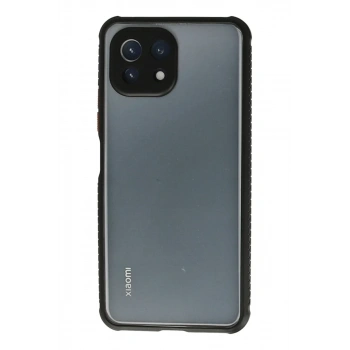 Xiaomi Mİ 11 Lite Kılıf Miami Şeffaf Silikon - Siyah