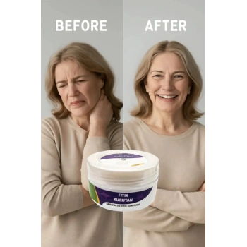 Süper Fıtık Kurutan Krem 50 ml