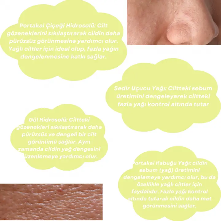 Skin Care Toner - Yağlı Ciltler İçin Cilt Bakım Suyu