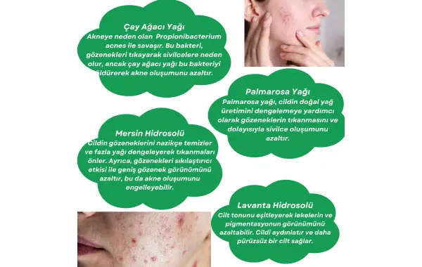 Akne ile Mücadelede Aromaterapi: Doğal ve Etkili Çözümler