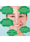 ANTI-ACNE SERUM Akne Karşıtı Yüz Serumu