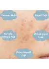 ANTI-BLEMISH SERUM Leke Giderici Cilt Bakım Serumu