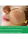 ANTI-ACNE TONER Çay Ağacı ve Palmarosa Özlü Cilt Bakım Suyu