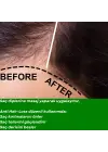 ANTI HAIR LOSS- 10 FORCES Saç Dökülmelerine Karşı 10 Aromatik Yağ Karışımı