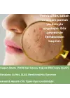 Skin Care Toner - Akneli Ciltler İçin Cilt Bakım Suyu