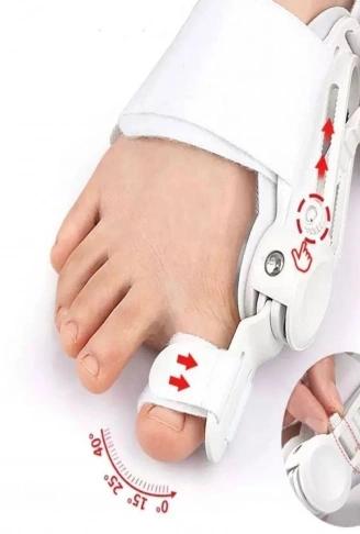 Ayarlanabilir Ayak Baş Parmak Kemik Düzeltici – Halluks Valgus (Bunyon) Aparatı, Gece Gündüz Kullanıma Uygun Ayak Düzeltme Ateli (4940)