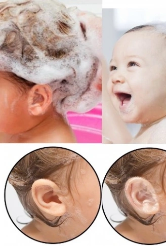 Su Geçirmez Yapışkanlı Kulak Koruyucu Bant 10 lu Paket (4940)