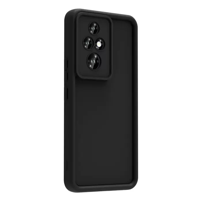 Honor 200 Pro Kılıf Kamera Korumalı Lopard Ananas Kapak