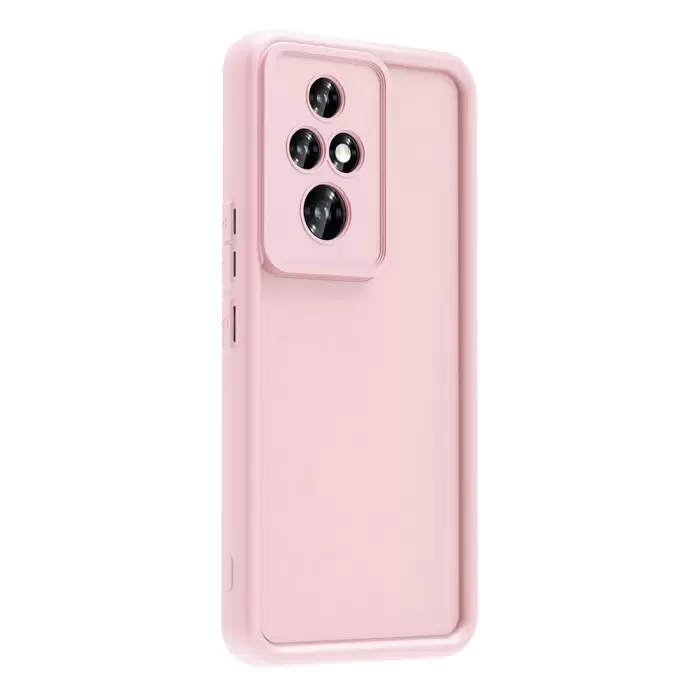 Honor 200 Pro Kılıf Kamera Korumalı Lopard Ananas Kapak