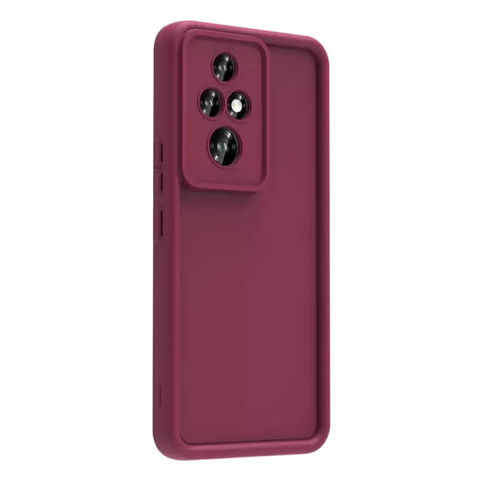 Honor 200 Pro Kılıf Kamera Korumalı Lopard Ananas Kapak