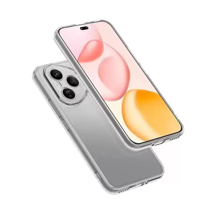 Honor 400 Pro Kılıf Lopard Kamera Korumalı Renksiz Şeffaf Esnek Silikon Kapak Süper