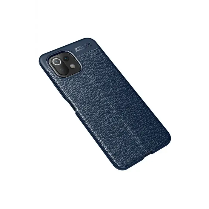 Lopard Xiaomi Mi 11 Lite Kılıf Auto Focus Kapak - Lacivert