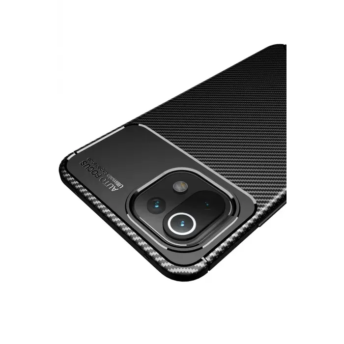Lopard Xiaomi Mi 11 Lite Kılıf Auto Focus Karbon Kapak - Kahverengi