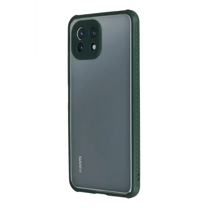 Lopard Xiaomi Mi 11 Lite Kılıf Miami Şeffaf Silikon - Koyu Yeşil